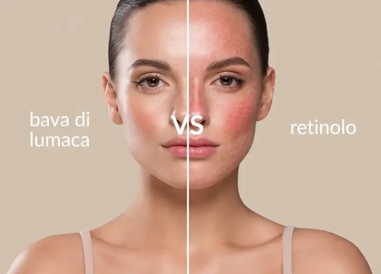 confronto visivo bava di lumaca vs retinolo irritazione pelle