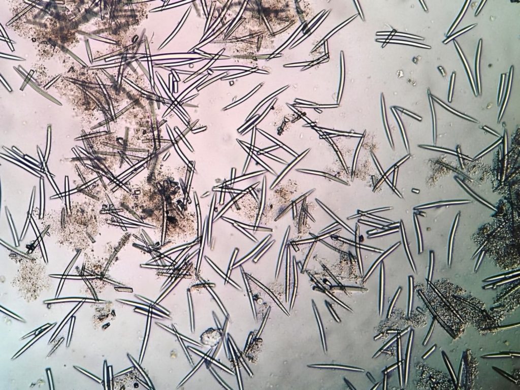 Spicule al giorno d'oggi